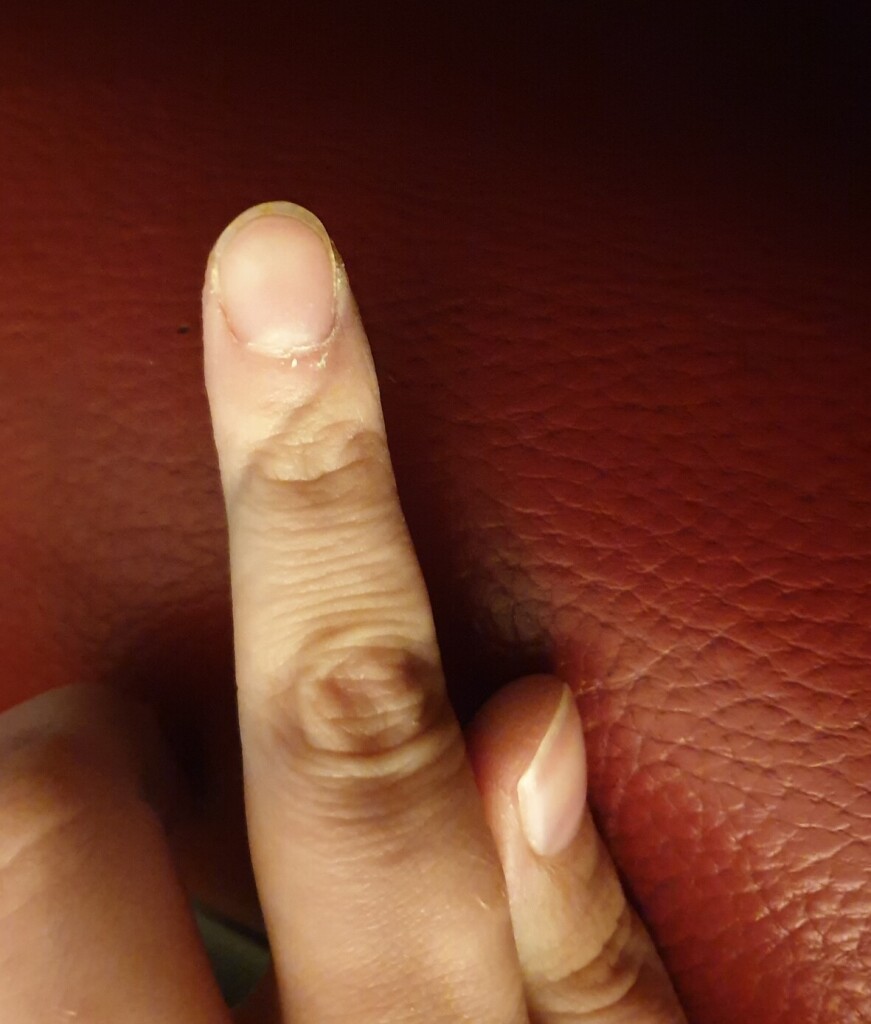 an indentation wrapping round the tip of my left index finger, where i hold the yarn